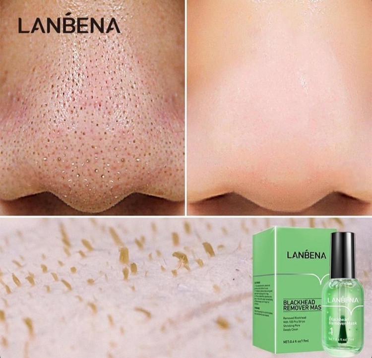 خرید چسب بینی لاکی اورجینال LANBENA لانبنا قابل استقاده برروی گونه، چانه و بینی و دارای قدرت چسبندگی بالا با بهترین قیمت